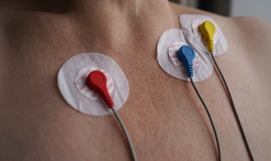 ECG Electrode Selection: Key Factors for B2B Medical Buyers